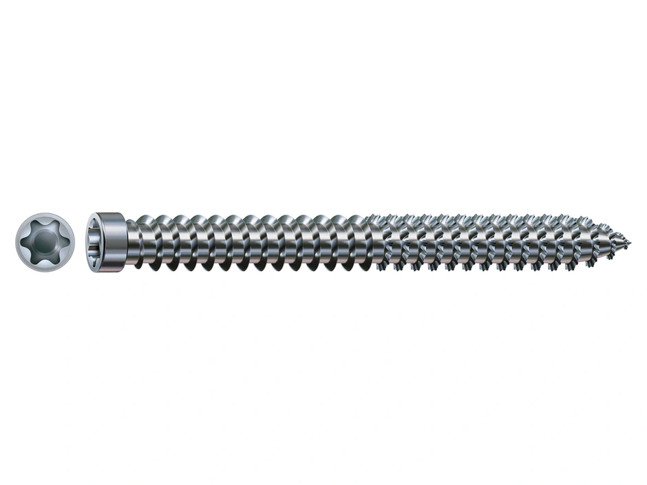 SPAX SPAX-RA Wirox Zylinderkopf VG T30 Ø7,5×120 mm 100 St.