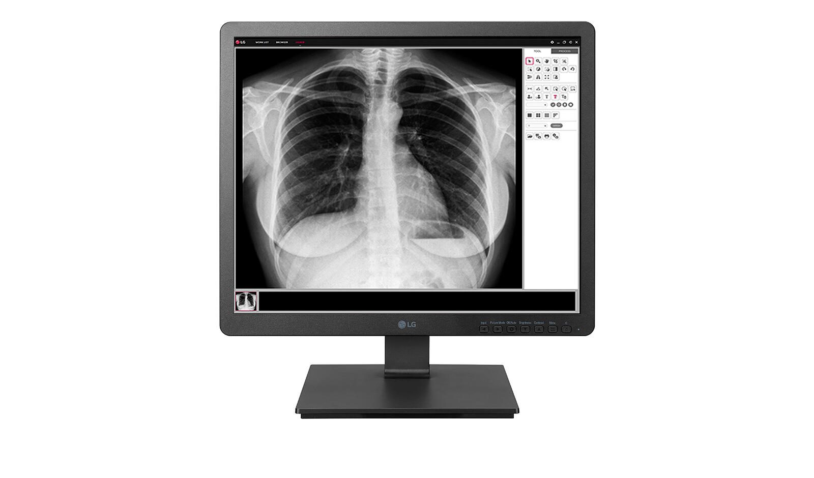 LG 19HK312C klinischer Monitor 48,3 cm (19″)