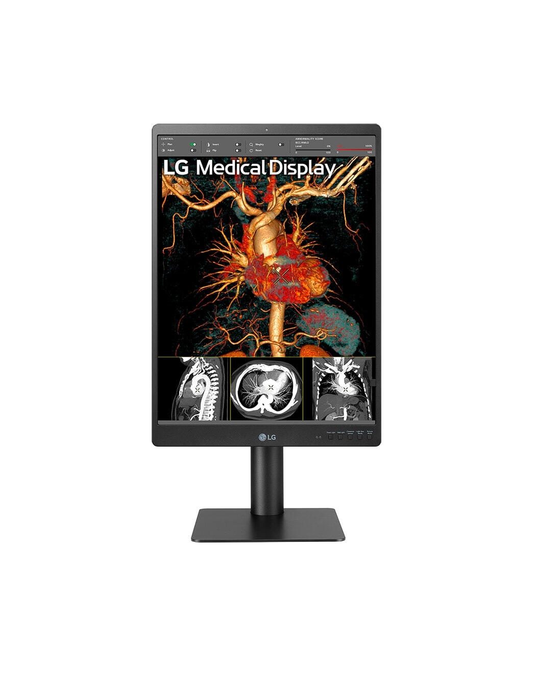 LG 21HQ513D-B Diagnosemonitor 54,1 cm (21.3″)